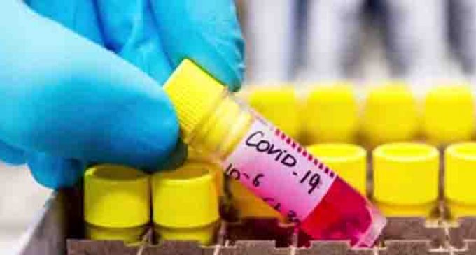 വയനാട് ജില്ലയില് 172 പേര്ക്ക് കൂടി കോവിഡ്; 111 പേര് രോഗമുക്തി നേടി