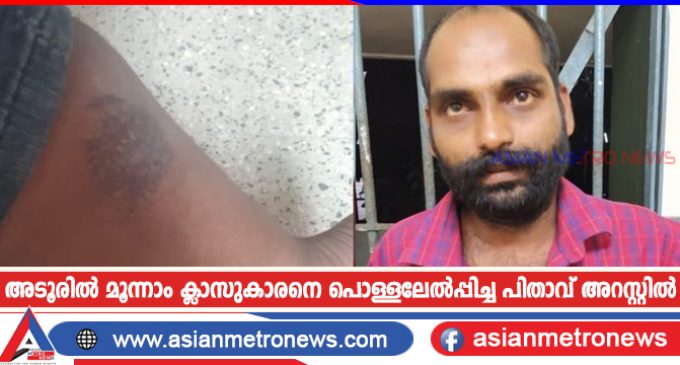 അടൂരിൽ മൂന്നാം ക്ലാസുകാരനെ പൊള്ളലേൽപ്പിച്ച പിതാവ് അറസ്റ്റിൽ